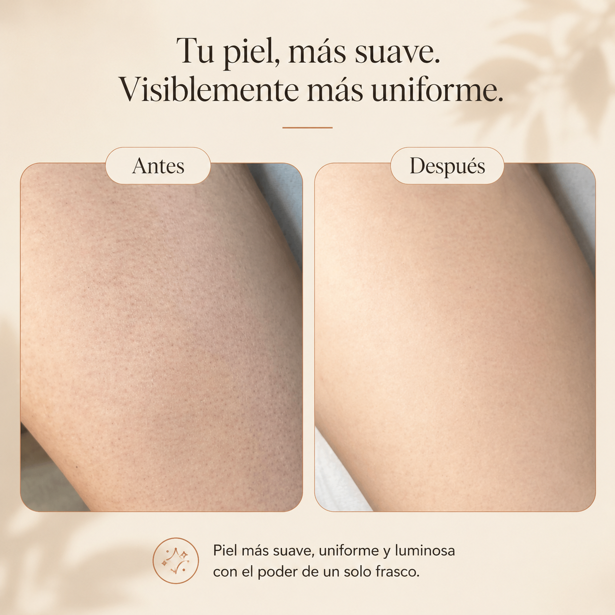 Tersa — Crema corporal multiácida
